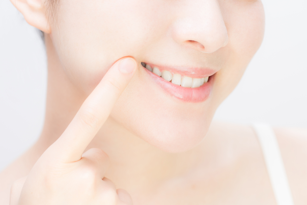 歯冠長延長術以外のガミースマイル治療は？上唇粘膜切除術も選択肢になる
