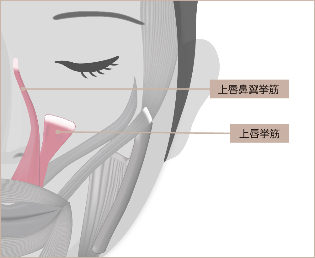 ④上唇を引っ張る筋肉が過度に発達している