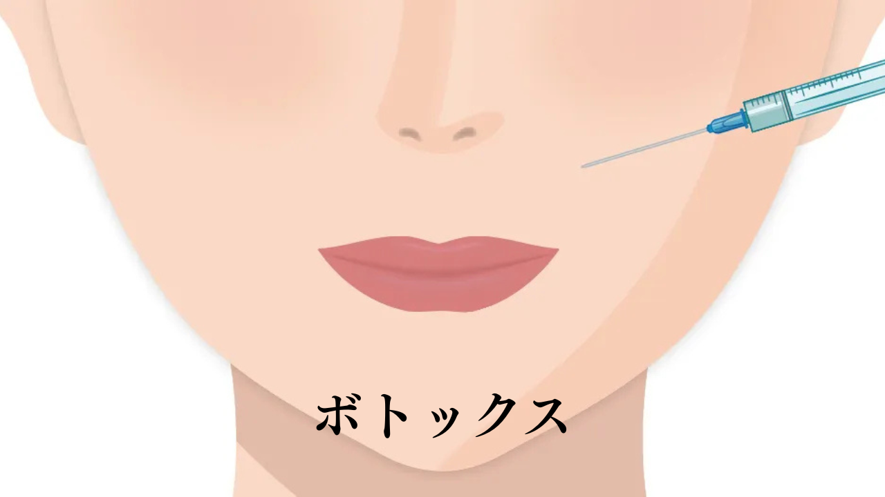 image_tooltip ボトックス・上唇粘膜切除術(筋肉・唇が原因の場合)