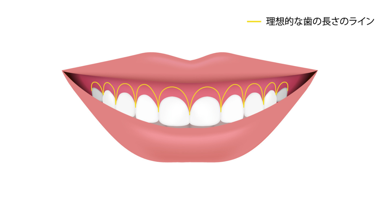 image_tooltip 理想的な歯の長さのライン