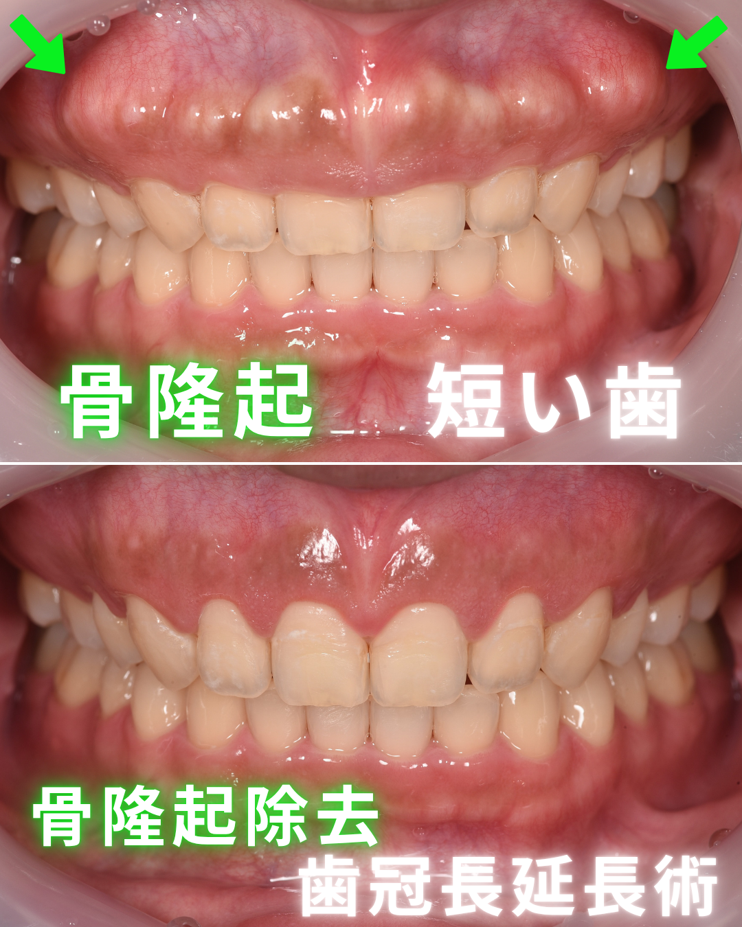 image_tooltip 症例
