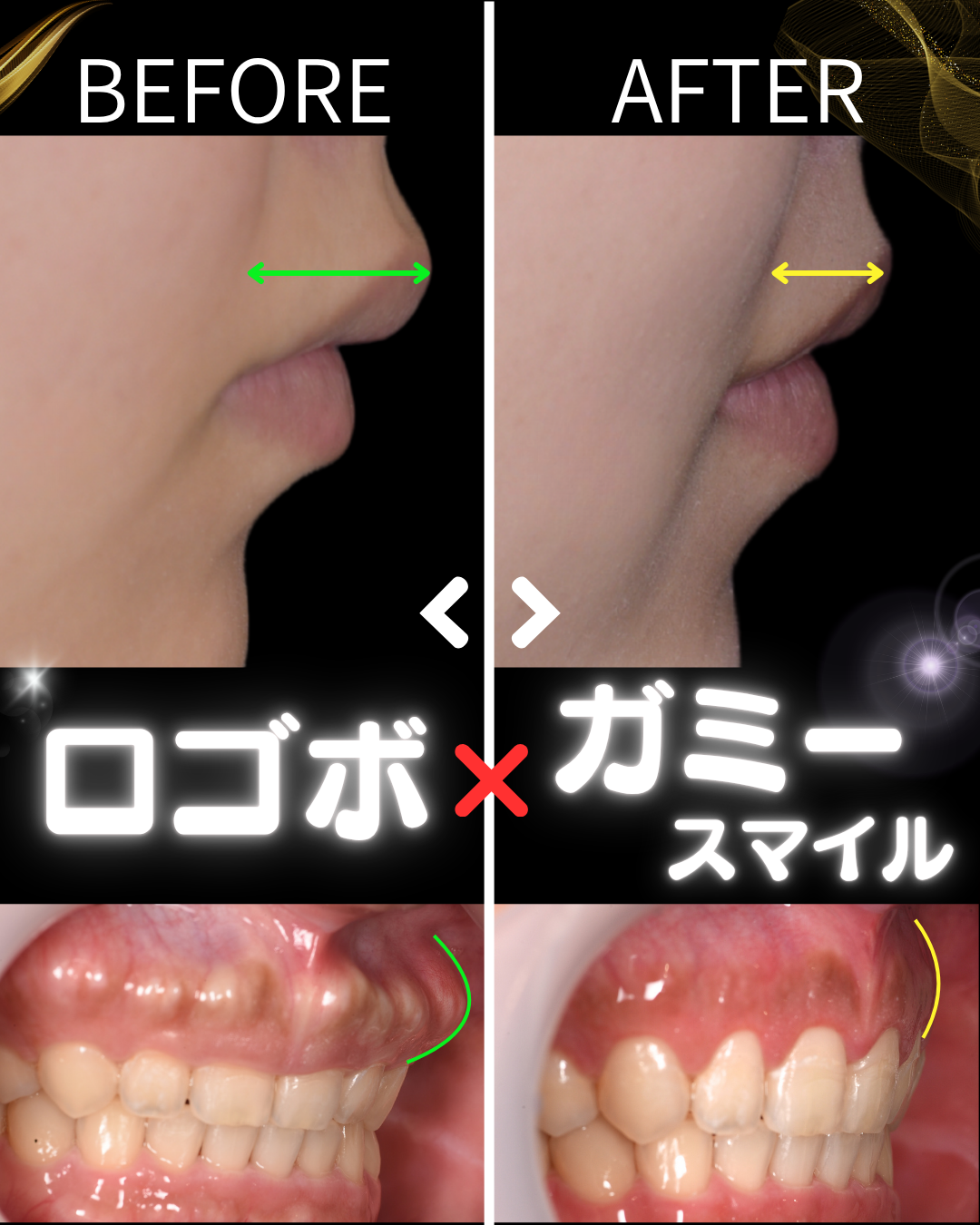 image_tooltip 症例