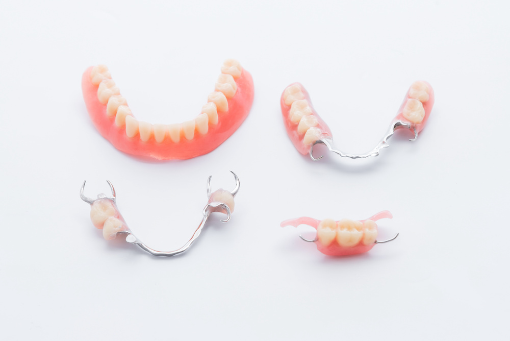 入れ歯の種類｜保険と自費・部分入れ歯と総入れ歯