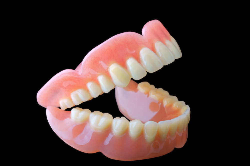 総入れ歯からインプラントに変えることはできる？