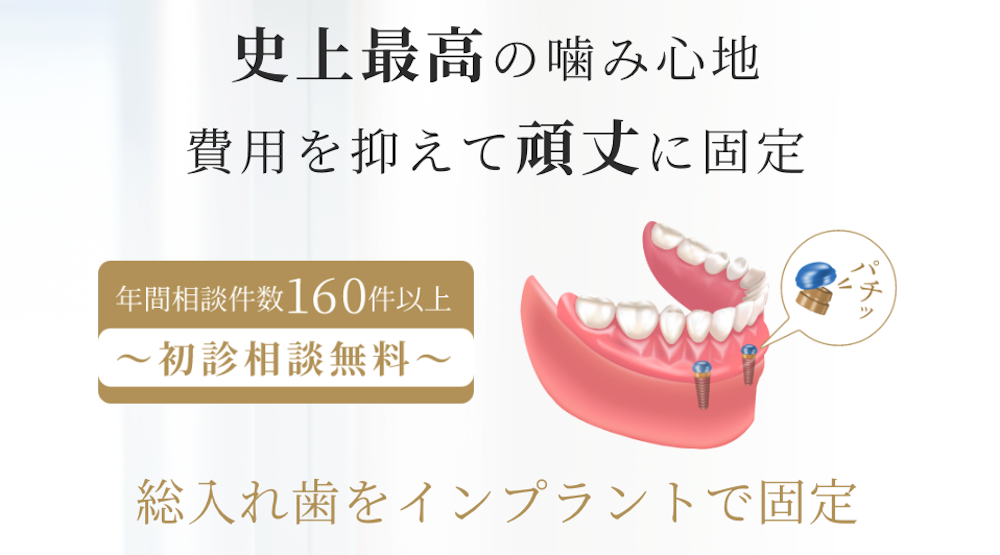 しっかり噛みたい方へ｜入れ歯が安定しない・歯が少ない場合の選択肢