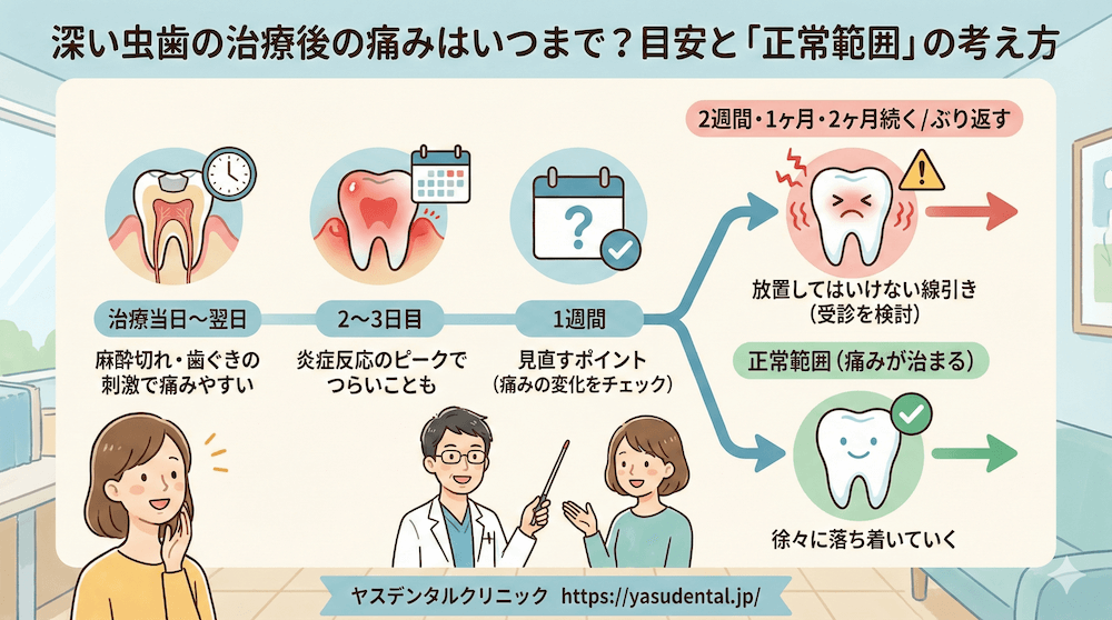 深い虫歯の治療後の痛みはいつまで?目安と「正常範囲」の考え方