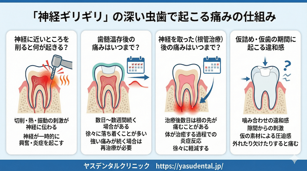 「神経ギリギリ」の深い虫歯で起こる痛みの仕組み