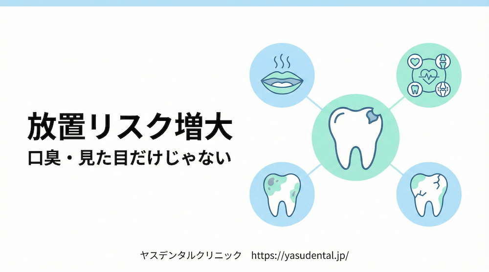 虫歯を放置すると増えるリスク|口臭・見た目だけで終わらない