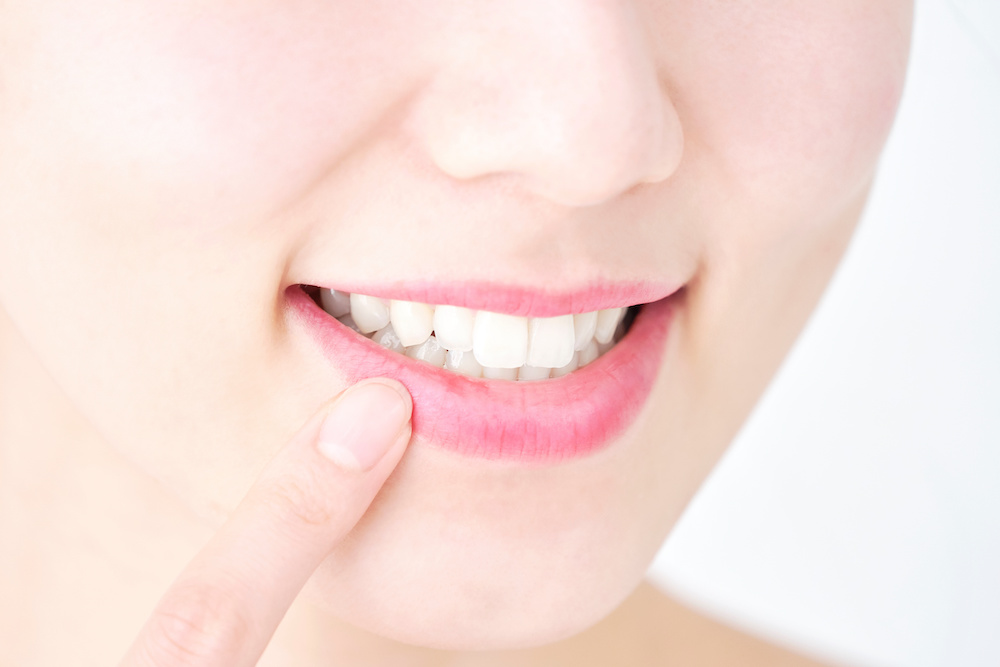 出っ歯はセラミック矯正で治療できる？後悔しないためには？