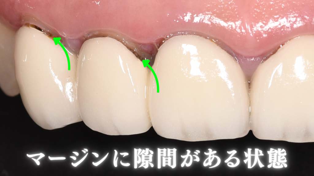image_tooltip マージンに隙間がある状態