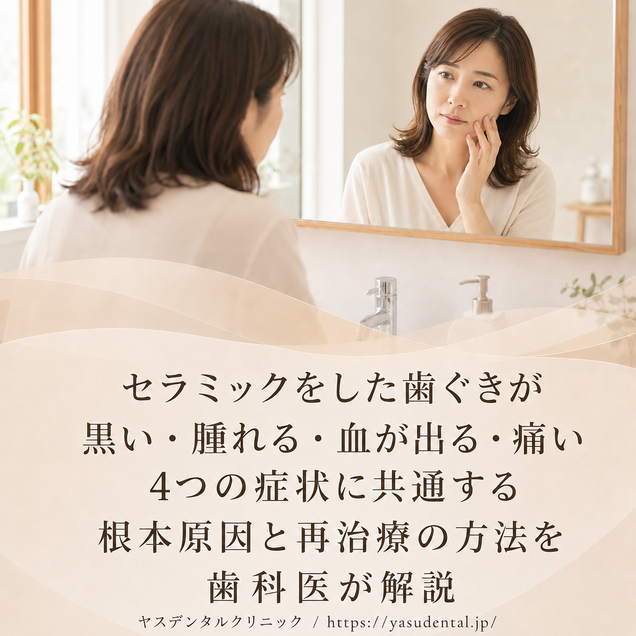 セラミックをした歯茎が黒い・腫れる・血が出る・痛い｜4つの症状に共通する根本原因と、再治療で治す方法 『セラミックを入れたのに、歯と歯ぐきの境目が黒い』 『歯ぐきが腫れて、歯磨きのたびに血が出る』 『被せた歯のまわりが痛い、においも気になる』 セラミック治療を受けたあと、このようなお悩みを抱えて当院へご相談に来られる方は少なくありません。実はこの「黒い・腫れる・血が出る・痛い」という症状は、それぞれ別々のトラブルのように見えて、その多くが「歯とセラミックの適合不良（すき間）」という一つの原因からつながって起きています。 大阪・天王寺区でセラミック矯正と歯列矯正の両方に対応するヤスデンタルクリニックでは、他院で受けたセラミックのトラブルや、やり直し（リカバリー）治療を専門的に行っております。セラミックのやり直しは難易度の高い治療のため、どこの歯科医院でも行えるというわけではありませんが、当院では院長・松井泰隆が専門的に対応しております。 当院の症例をまじえながら、それぞれの原因や対処法を詳しくご説明していきますので、ご覧いただければ、必ず解決策が見つかると思います。