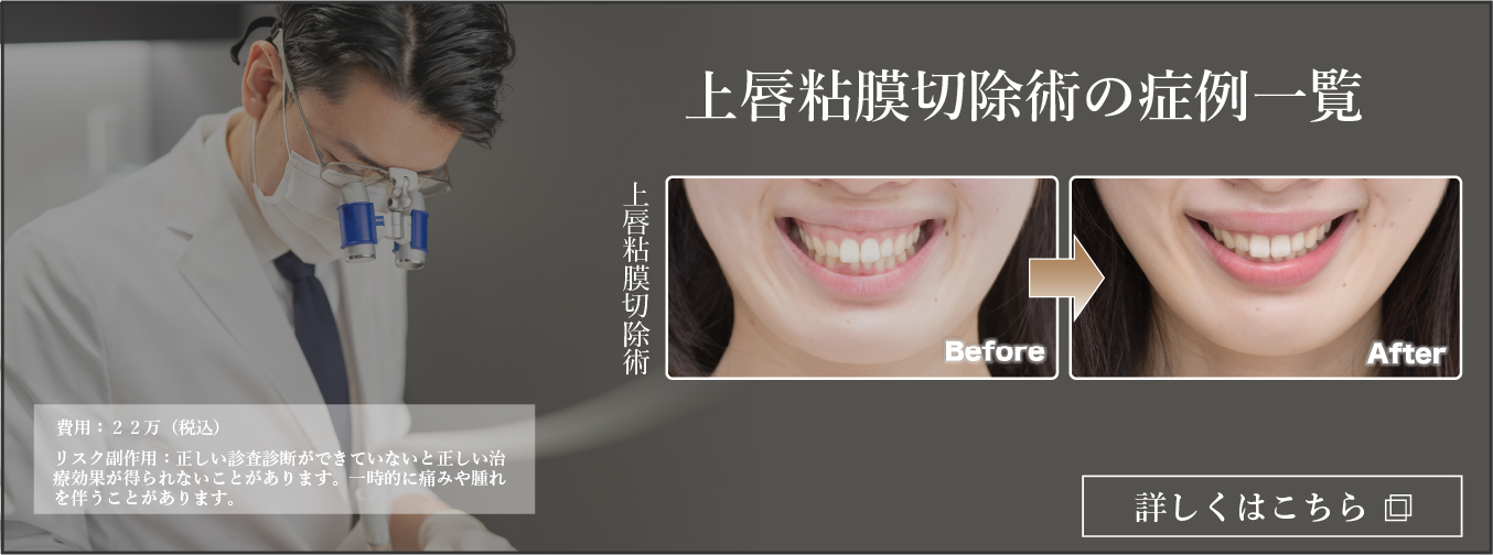 上唇粘膜切除術の症例一覧
