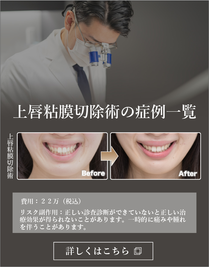 上唇粘膜切除術の症例一覧